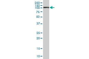 MCAM MaxPab polyclonal antibody. (MCAM antibody  (AA 1-646))
