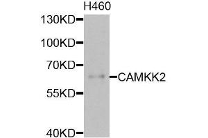 Western blot analysis of extracts of H460 cells, using CAMKK2 antibody (ABIN6003631) at 1/1000 dilution. (CAMKK2 antibody)