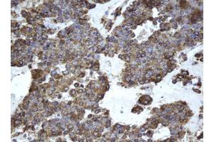 Image no. 4 for anti-Epoxide Hydrolase 1, Microsomal (Xenobiotic) (EPHX1) (AA 21-230) antibody (ABIN1491197)