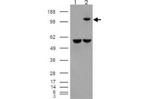 293 overexpressing IDE and probed with IDE polyclonal antibody  (mock transfection in first lane), tested by Origene. (IDE antibody)