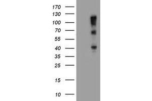 HEK293T cells were transfected with the pCMV6-ENTRY control (Left lane) or pCMV6-ENTRY FBXO31 (Right lane) cDNA for 48 hrs and lysed. (FBXO31 antibody)