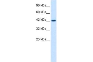 Western Blotting (WB) image for anti-Zona Pellucida Glycoprotein 3 (ZP3) antibody (ABIN2461230)
