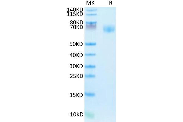 IFNGR1 Protein (AA 18-245) (Fc Tag)