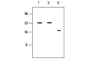 Human recombinant protein kIR2DL1, kIR2DL3 and kIR2DL4 (each 20ng per well) were resolved by SDS-PAGE, transferred to PVDF membrane and probed with anti-human kIR2D (1:500). (KIR2D antibody  (AA 44-202))