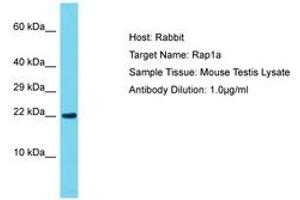 Image no. 1 for anti-RAP1A, Member of RAS Oncogene Family (RAP1A) (C-Term) antibody (ABIN6750499)
