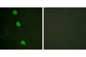 P-peptide - +Immunofluorescence analysis of HeLa cells, using CaMK4 (Phospho-Thr196/200) antibody.