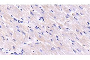Detection of CSN3 in Bovine Cardiac Muscle Tissue using Polyclonal Antibody to Casein Kappa (CSN3) (CSN3 antibody  (AA 22-190))