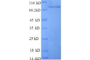 SDS-PAGE (SDS) image for Major Royal Jelly Protein 1 (MRJP1) (AA 20-432) protein (GST tag) (ABIN5711193)