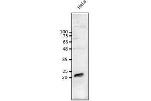 Anti-Rab1b Ab at 1/1,000 dilution: lysates at 50 µg per Iane, rabbit polyclonal to goat (HRP) at 1/10,000 dilution, (RAB1B antibody  (C-Term))
