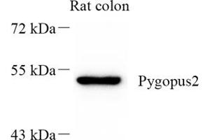 Western blot analysis of Pygopus2 (ABIN7075325) at dilution of 1: 300 (PYGO2 antibody)