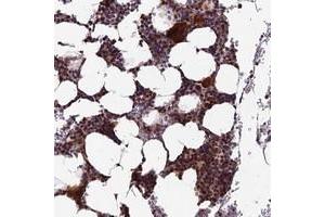 Immunohistochemical staining of human bone marrow with KIAA1984 polyclonal antibody  shows strong cytoplasmic and nuclear positivity in hematopoietic cells at 1:200-1:500 dilution. (CCDC183/KIAA1984 antibody)