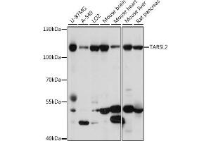 Western blot analysis of extracts of various cell lines, using T antibody (ABIN7270816) at 1:1000 dilution. (TARSL2 antibody  (AA 1-170))