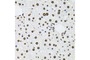 Immunohistochemistry of paraffin-embedded mouse liver using MCL1 antibody at dilution of 1:100 (x40 lens). (MCL-1 antibody)