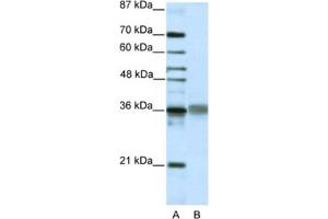 Western Blotting (WB) image for anti-T-Cell Leukemia Homeobox 2 (TLX2) antibody (ABIN2461873) (TLX2 antibody)