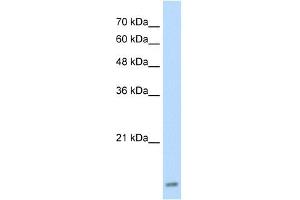 UBE2I antibody used at 2. (UBE2I antibody)