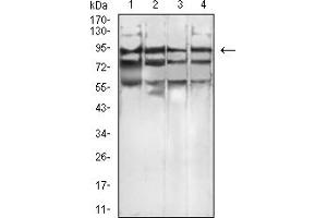 Western Blotting (WB) image for anti-Fibroblast Growth Factor Receptor 4 (FGFR4) (AA 22-369) antibody (ABIN7193467)