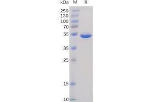 Human BAFF Protein, hFc Tag on SDS-PAGE under reducing condition.