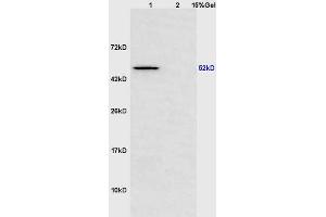 Lane 1: mouse heart lysates Lane 2: mouse brain lysates probed with Anti Scavenger Receptor BII Polyclonal Antibody, Unconjugated (ABIN873185) at 1:200 in 4 °C. (SCARB2 antibody  (AA 181-280))