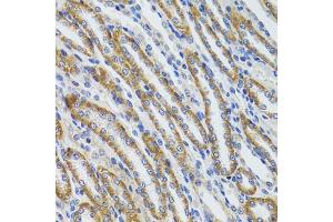 Immunohistochemistry of paraffin-embedded mouse kidney using HEXA antibody (ABIN6127519, ABIN6141730, ABIN6141732 and ABIN6216071) at dilution of 1:100 (40x lens). (Hexosaminidase A antibody  (AA 270-529))