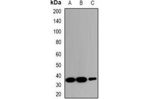 Western blot analysis of ZNT2 expression in HeLa (A), RAW264. (SLC30A2 antibody)