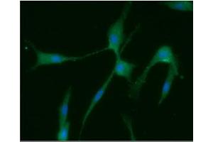 ICC/IF analysis of Homer1 in U87MG cells line, stained with DAPI (Blue) for nucleus staining and monoclonal anti-human Homer1 antibody (1:100) with goat anti-mouse IgG-Alexa fluor 488 conjugate (Green). (HOMER1 antibody  (AA 1-354))