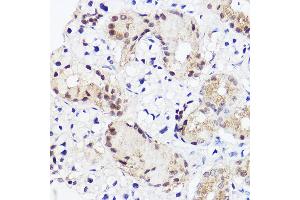 Immunohistochemistry of paraffin-embedded mouse salivary gland using RUNX2 Rabbit pAb (ABIN3016833, ABIN3016834, ABIN3016835 and ABIN6219851) at dilution of 1:100 (40x lens). (RUNX2 antibody  (AA 242-521))