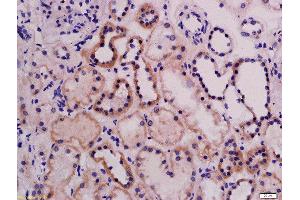 Formalin-fixed and paraffin embedded rat kidney labeled with Rabbit Anti-ABI3 Polyclonal Antibody, Unconjugated  at 1:200 followed by conjugation to the secondary antibody and DAB staining (ABI3 antibody  (AA 151-250))