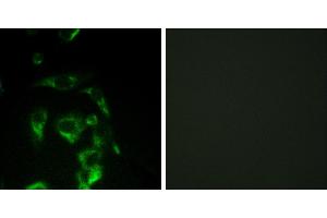 Peptide - +Immunohistochemistry analysis of paraffin-embedded human colon carcinoma tissue using Eif4g antibody. (EIF4G1 antibody  (Internal Region))