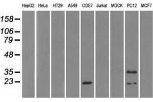 Western blot analysis of extracts (35 µg) from 9 different cell lines by using anti-CRYAB monoclonal antibody. (CRYAB antibody)