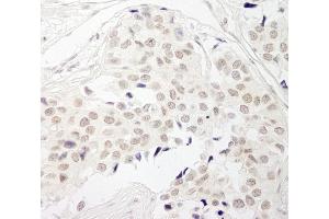 Immunohistochemistry (IHC) image for anti-Protein Phosphatase 1, Catalytic Subunit, beta Isoform (PPP1CB) (C-Term) antibody (ABIN7453865)
