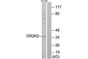 Western blot analysis of extracts from HT-29 cells, using OR2K2 Antibody. (OR2K2 antibody  (AA 241-290))