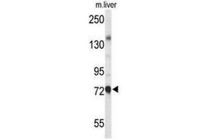 Western blot analysis of CHAT Antibody (N-term) in mouse liver tissue lysates (35µg/lane). (Choline Acetyltransferase antibody  (N-Term))