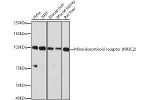 Western blot analysis of extracts of various cell lines, using Mineralocorticoid receptor (NR3C2) antibody (ABIN1681109, ABIN3017672, ABIN3017673 and ABIN6220207) at 1:1000 dilution.