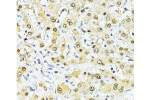 Immunohistochemistry of paraffin-embedded Human liver using ITGB3BP Polyclonal Antibody at dilution of 1:100 (40x lens). (ITGB3BP antibody)