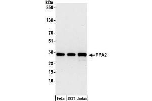 anti-Pyrophosphatase 2 (PPA2) (AA 284-334) antibody