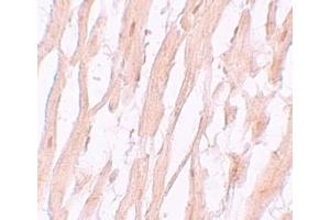 Immunohistochemistry (IHC) image for anti-ATG9 Autophagy Related 9 Homolog A (S. Cerevisiae) (ATG9A) (C-Term) antibody (ABIN1030264) (ATG9A antibody  (C-Term))
