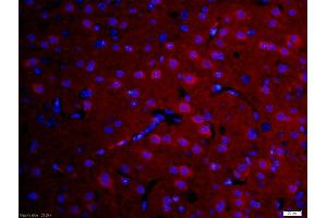 Formalin-fixed and paraffin-embedded rat brain labeled with Anti-DFFB Polyclonal Antibody, Unconjugated (ABIN724085) 1:200, overnight at 4°C, The secondary antibody was Goat Anti-Rabbit IgG, Cy3 conjugated used at 1:200 dilution for 40 minutes at 37°C. (DFFB antibody  (AA 201-260))