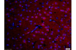 Formalin-fixed and paraffin-embedded rat brain labeled with Anti-DFFB Polyclonal Antibody, Unconjugated (ABIN724085) 1:200, overnight at 4°C, The secondary antibody was Goat Anti-Rabbit IgG, Cy3 conjugated used at 1:200 dilution for 40 minutes at 37°C. (DFFB antibody  (AA 201-260))