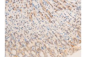 Immunohistochemistry (IHC) image for anti-Epidermal Growth Factor Receptor (EGFR) (pSer1071) antibody (ABIN6256098)