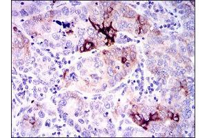 Immunohistochemistry (IHC) image for anti-Secreted phosphoprotein 1 (SPP1) (AA 167-314) antibody (ABIN1845756) (Osteopontin antibody  (AA 167-314))