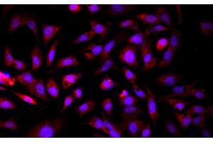 Immunofluorescence analysis of HepG2 cells using GCK Polyclonal Antibody at dilution of 1:100 (GCK antibody)