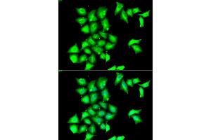 Immunofluorescence analysis of HeLa cells using MSRB1 antibody (ABIN6129123, ABIN6144089, ABIN6144090 and ABIN6222462). (MSRB1 antibody  (AA 1-94))