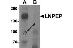 Western Blotting (WB) image for anti-Leucyl/cystinyl Aminopeptidase (LNPEP) (C-Term) antibody (ABIN1077382) (LNPEP antibody  (C-Term))