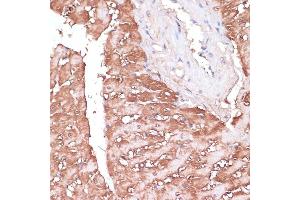Immunohistochemistry of paraffin-embedded rat heart using GEMIN5 antibody (ABIN7267367) at dilution of 1:100 (40x lens).