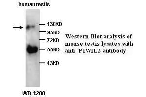 Image no. 1 for anti-Piwi-Like 2 (PIWIL2) (C-Term) antibody (ABIN791010) (PIWIL2 antibody  (C-Term))