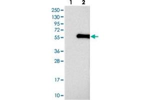 Western blot analysis of Lane 1: Negative control (vector only transfected HEK293T lysate), Lane 2: Over-expression Lysate (Co-expressed with a C-terminal myc-DDK tag (~3. (ABHD8 antibody)