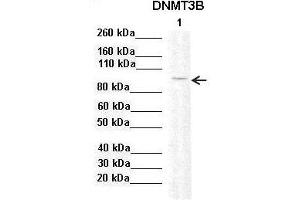 Sample Type :  Lane 1: 20ug mouse mesenchymal stem cell lysate  Primary Antibody Dilution :   1:2000  Secondary Antibody:  Anti-rabbit-HRP  Secondary Antibody Dilution:   1:10,000  Color/Signal Descriptions:  DNMT3B  Gene Name:  Anonymous  Submitted by: (DNMT3B antibody  (Middle Region))