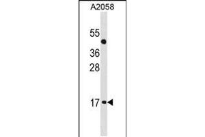 Western blot analysis in A2058 cell line lysates (35ug/lane). (ATOH7 antibody  (AA 85-112))