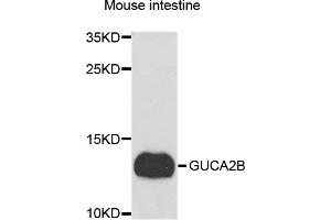 Western blot analysis of extracts of mouse small intestine, using GUCA2B antibody.