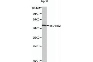 Western blot analysis of extracts of HepG2 cells, using HSD11B2 antibody (ABIN6129828, ABIN6142000, ABIN6142001 and ABIN6224104) at 1:1000 dilution. (HSD11B2 antibody  (AA 266-405))